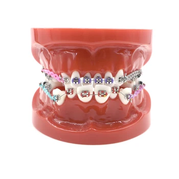 Stomatološka ortodontske terapije Model zuba s metalnim nosača luk u obliku žičane vezice