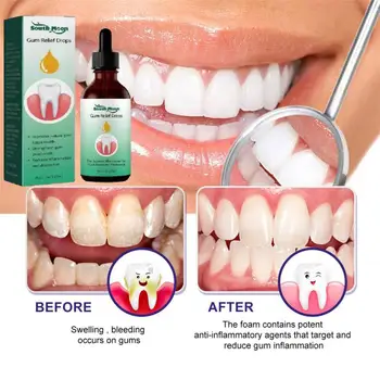 30 ml popravak kapi, čišćenje i izbjeljivanje zubi, удаляющих макулярное mrlja, smirivanje desni, kapi za popravak zuba, pasta za zube, oralna higijena, čisti njega