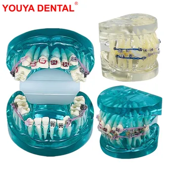 Novi model zuba ortodontske terapije, standardna edukativne model, model zuba s nosačem, pola metalne, pola keramika, 2 boje
